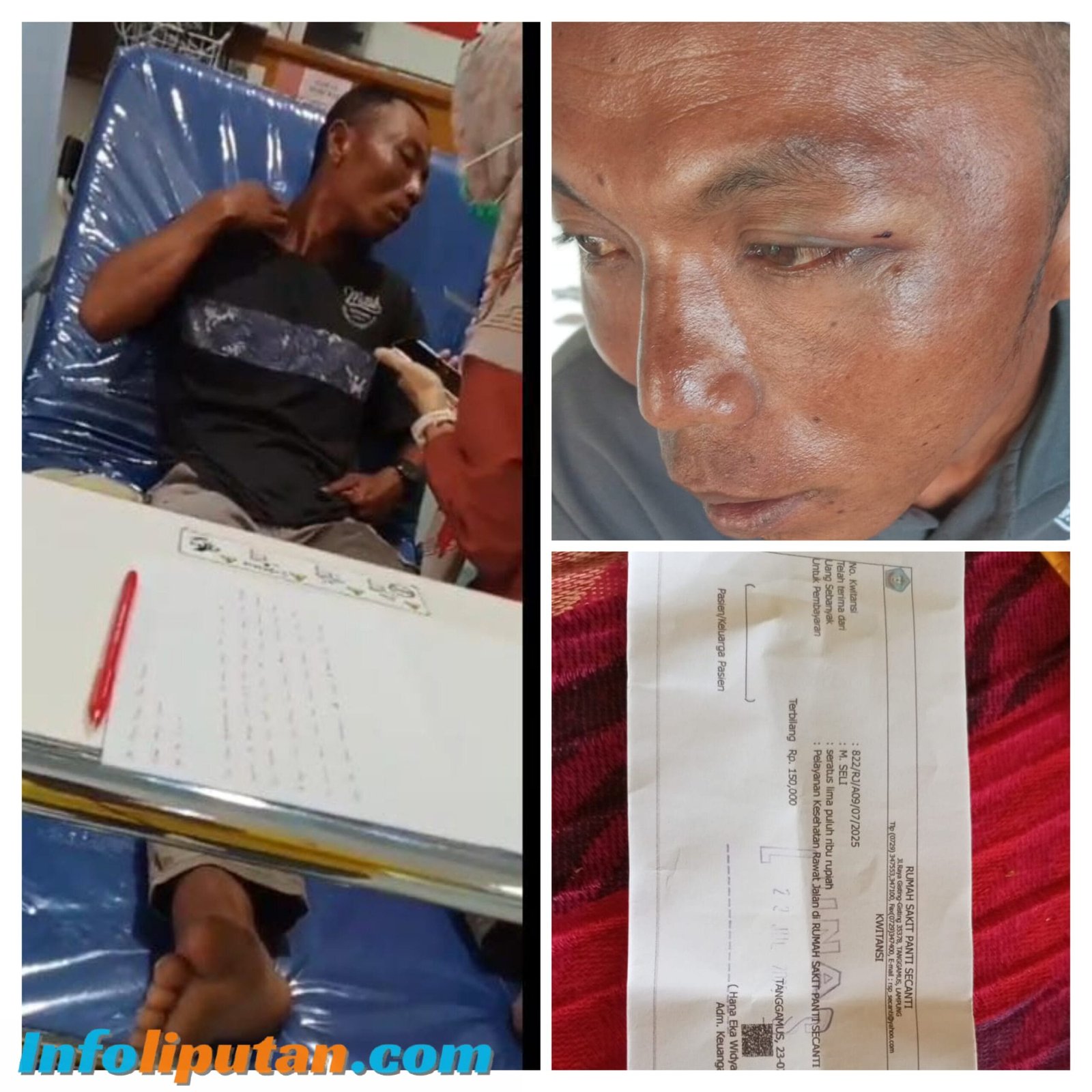 Warga Pekon Tanjung Begelung Diduga Dianiaya, Korban Alami Lebam di Wajah dan Pelipis