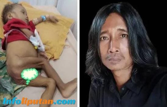Warga Bayas Warga Dusun Congkanan Desa Bayas Jaya Kurang Gizi JWI DPW Lampung Angkat Bicara